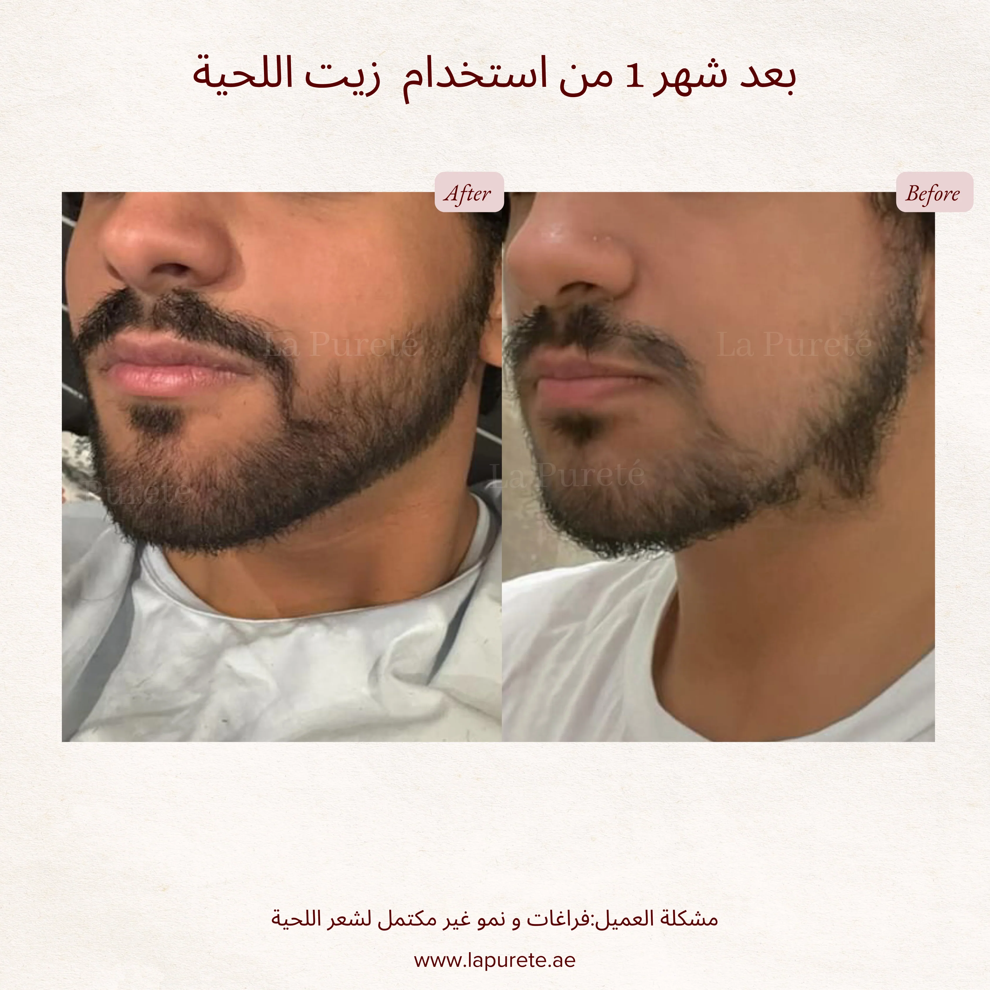 زيت اللحية والشارب - Image 3